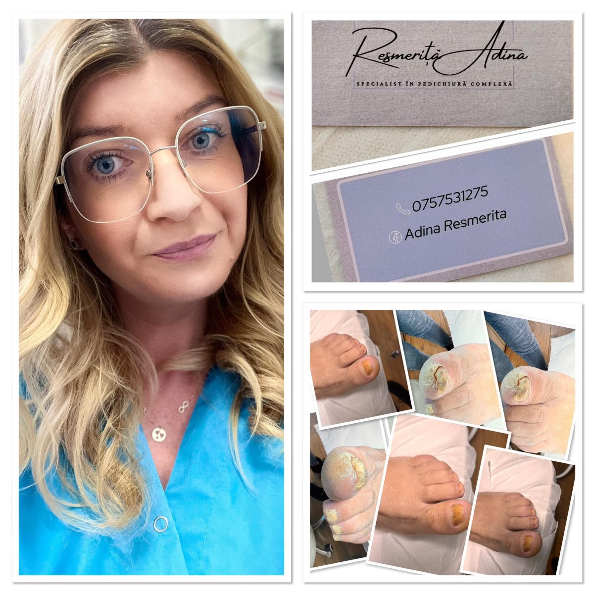 Colaj de prezentare cu Adina Resmerita, cărți de vizită și fotografii din activitatea de pedichiură